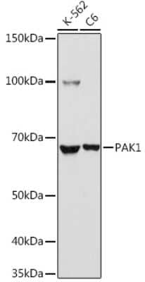 Western Blot: PAK1 Antibody [NBP2-95107] - Western blot analysis of extracts of various cell lines, using PAK1 antibody (NBP2-95107) at 1:1000 dilution. Secondary antibody: HRP Goat Anti-Rabbit IgG (H+L) at 1:10000 dilution. Lysates/proteins: 25ug per lane. Blocking buffer: 3% nonfat dry milk in TBST. Detection: ECL Basic Kit. Exposure time: 90s.